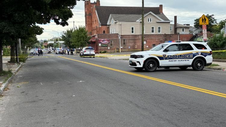 Teen hospitalized after shooting on Dixwell Avenue: New Haven police